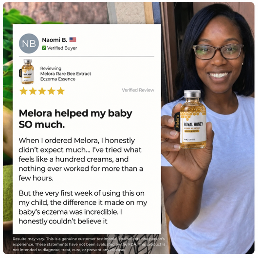 Melora Bee Extract Eczema Essence